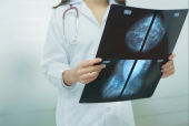 Рентгенография одной молочной железы (после мастэктомии) в двух проекциях с описанием (маммография)