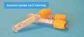Исследование уровня C-пептида в суточной моче