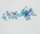 Цитологическое исследование гинекологического мазка окрашивание по Папаниколау (Рар-тест)