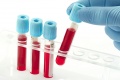 Биохимические исследования крови