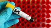 Анализ крови на вирус ВИЧ (иммунодефицита человека) в г. Новый Уренгой