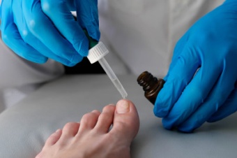 Анализ на определение днк грибов дерматофитов (dermatophytes) в соскобах с кожи и ногтевых пластинок методом пцр