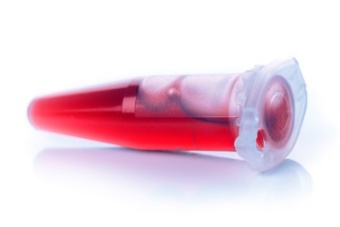 Клинический анализ крови + СОЭ и лейкоцитарная формула (медосмотр)