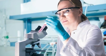 Исследование уровня антигена плоскоклеточной карциномы (SCC) в крови